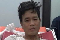 Vừa sát hại vợ, gã đàn ông liền bị rắn độc cắn