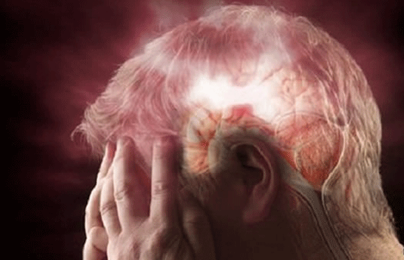 Gần 6.000.000 người trên thế giới bị chết vì đột quỵ mỗi năm ảnh 1