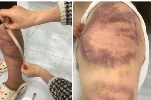 Làm rõ vụ đối tượng ngược đãi, hành hạ vợ con