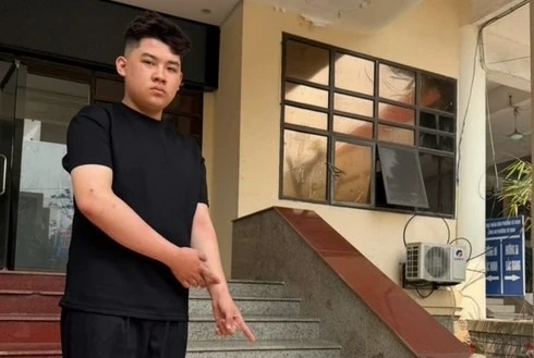 Thiếu niên 16 tuổi trộm cắp hơn 5 ‘cây’ vàng 