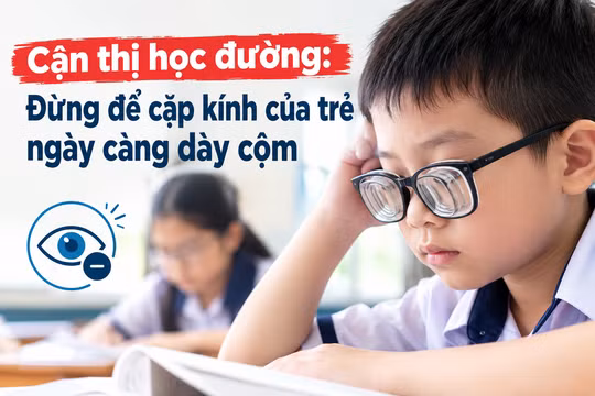Cận thị học đường: Đừng để cặp kính của trẻ ngày càng dày cộm