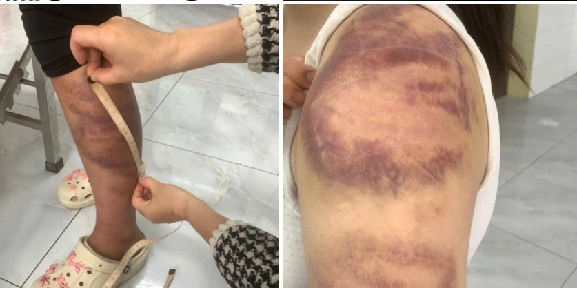 Làm rõ vụ đối tượng ngược đãi, hành hạ vợ con