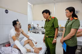 Thăm, động viên 2 chiến sĩ bị bỏng nặng khi chữa cháy xưởng nệm mút