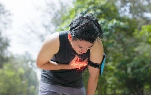 Dấu hiệu cảnh báo đột quỵ khi chơi thể thao