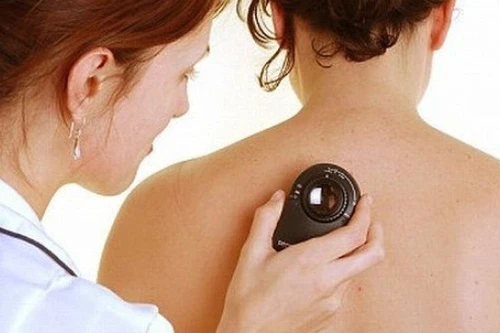 Những dấu hiệu ung thư dễ bị bỏ qua 