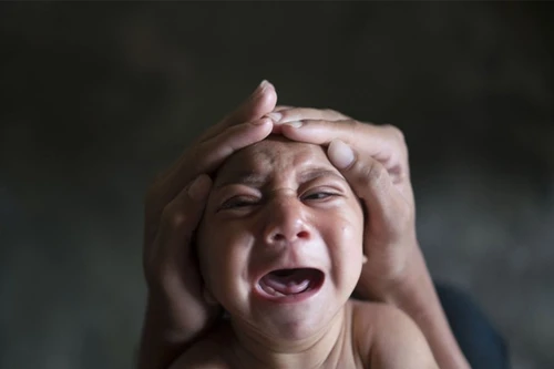 Zika đã vào Việt Nam, những trường hợp nào cần đi xét nghiệm?