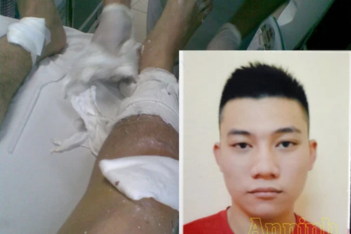 Bắt đối tượng côn đồ chém bị thương hai vợ chồng