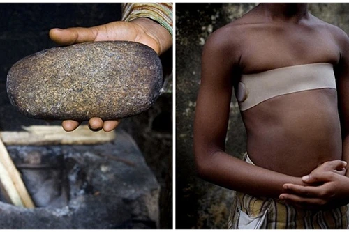 Kinh hãi tục "là ngực" giết chết cuộc sống của 3,8 triệu trẻ em gái ở châu Phi