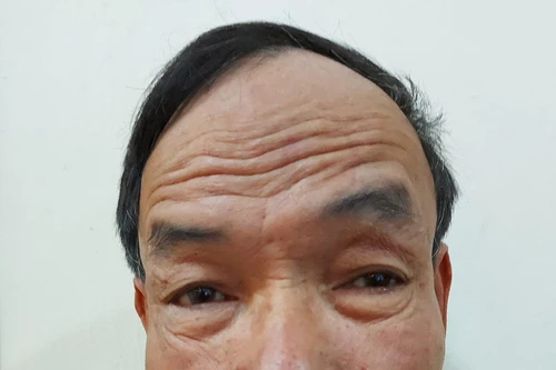 'Sở hữu' 4 tiền án, cai thầu xây dựng tiếp tục phạm tội