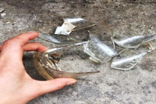 Cứu bé gái 16 tháng tuổi bị mảnh cốc thủy tinh đâm thủng bụng, ruột non chui ra ngoài