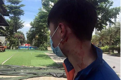 Truy bắt các đối tượng cướp điện thoại của tài xế 'xe ôm' công nghệ