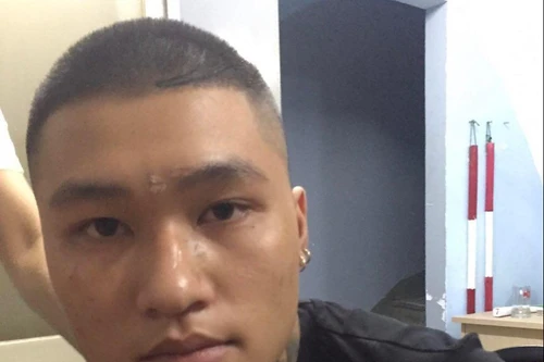 Bắt kẻ trốn truy nã sau khi chém người trong bữa nhậu