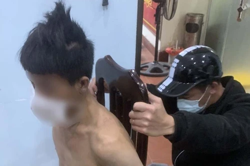 Nghĩ có người đuổi giết mình, đối tượng trèo lên nóc nhà ném gạch đá làm hỏng 4 xe ôtô