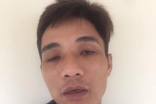 Gã nghiện điều khiển xe máy vô chủ đi mua ma túy 