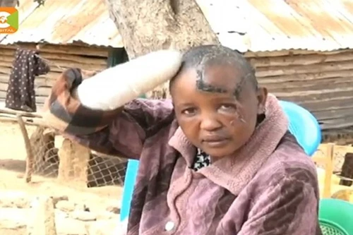 Chồng vô sinh chém vợ tàn bạo vì không sinh được con