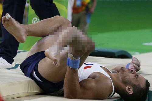 Khoảnh khắc kinh hoàng khi VĐV TDDC Pháp bị gãy gập chân tại Olympic