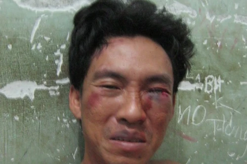 Nửa giờ giải cứu bé gái 8 tuổi thoát khỏi lưỡi dao của tên trộm hung tợn 