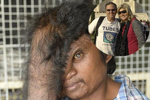 Vận may của người đàn ông mặt quỷ