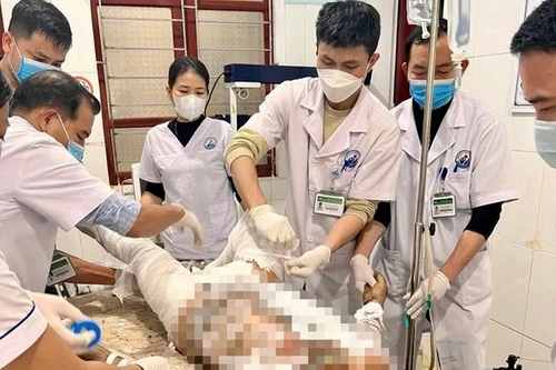 Cãi nhau với vợ, người đàn ông tự thiêu