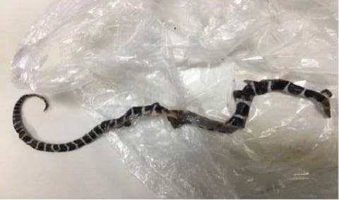 Cứu sống bé trai bị rắn cặp nia cắn