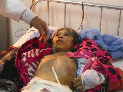 Đang điều tra vụ osin tố chủ hành hạ như thời trung cổ