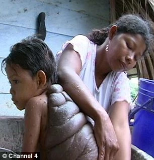 Sự phục hồi thần kì của “cậu bé rùa”