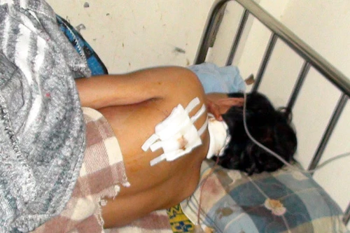 Vợ chồng sắp cưới bị côn đồ chém dã man trong phòng trọ