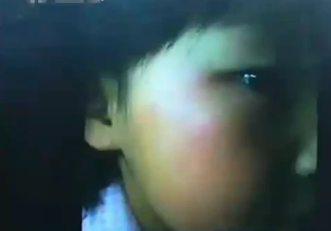 Không biết làm toán, bé mẫu giáo bị cô tát 70 cái