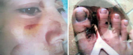 Thầy giáo bị tố đánh vợ dã man