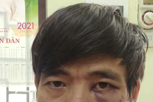 Khởi tố kẻ mặc đồng phục Grab, dùng mìn giả cướp tiền tại ngân hàng