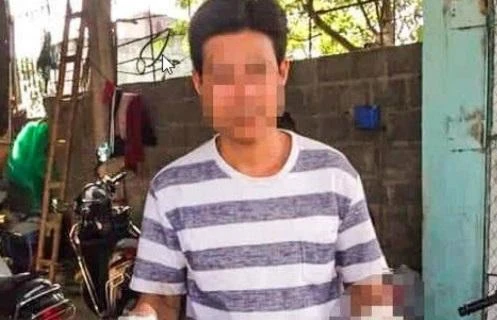 Dấu hiệu hình sự trong vụ phát hiện thi thể người đàn ông dưới ao