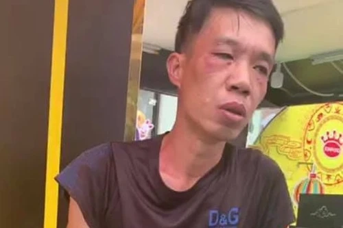 Chặn bắt tên trộm đang phóng xe máy tìm đường tẩu thoát