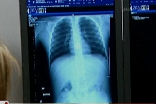 Kiểm soát chặt đối tượng đánh cắp và nuốt viên kim cương trị giá 20.000 USD