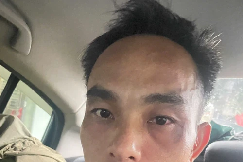 Bắt "nóng" đối tượng cướp xe máy chở bé gái giữa đêm khuya 