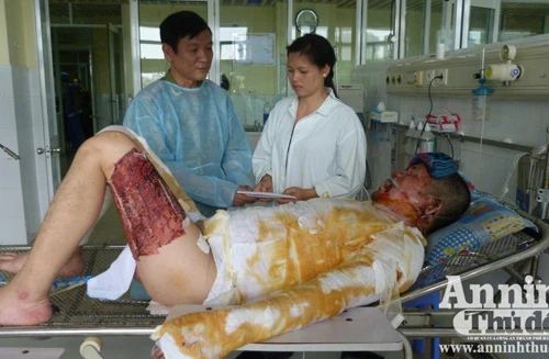 Thăm, tặng quà bảo vệ dân phố bị thương khi làm nhiệm vụ