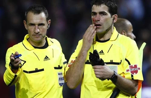 Hủy trận đấu vì trọng tài bị tấn công đổ máu