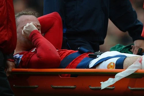 Rooney dính chấn thương nghiêm trọng