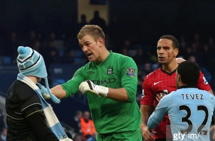 Ferdinand đổ máu trong trận derby