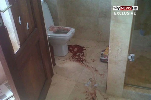 Lộ ảnh đẫm máu trong nhà Pistorius