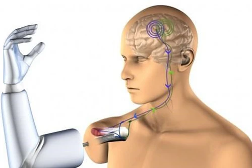  Nghiên cứu thành công cánh tay robot cho người liệt toàn thân.