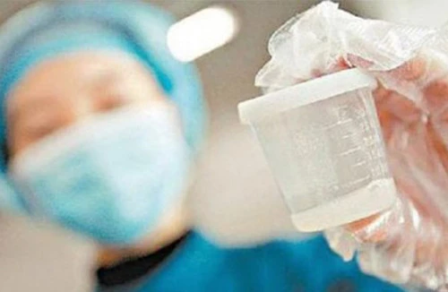 Bạn có biết về ngân hàng tinh trùng và thụ thai từ tinh trùng đông lạnh 15 năm?