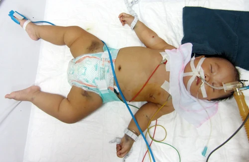 Vì quá nghèo, hai mẹ con uống thuốc diệt cỏ, mẹ chết, con 1 tuổi đang nguy kịch