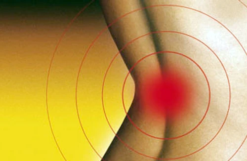 Đau lưng - dấu hiệu nguy hiểm không thể bỏ qua