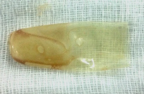 Bất cẩn khi trông trẻ, 2 cháu bé suýt tử vong