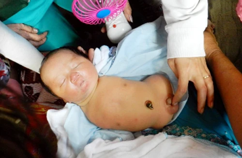 Cậu bé dị tật không chân tay kỳ lạ được phong làm "cậu hai" thần thánh ở An Giang