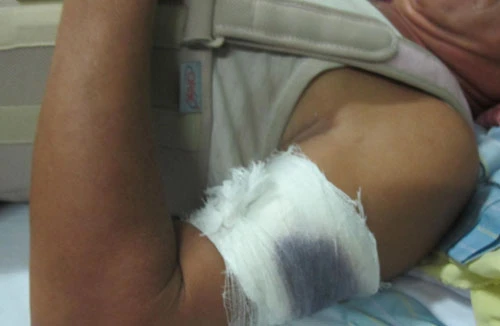 Hi hữu chuyện chủ nhà bị “cẩu tặc” chém trọng thương