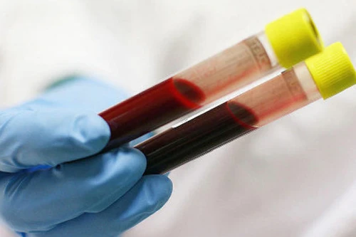 Làm rõ thông tin nghi ngờ nhân bản xét nghiệm tại BV Đa khoa Thạch Thất