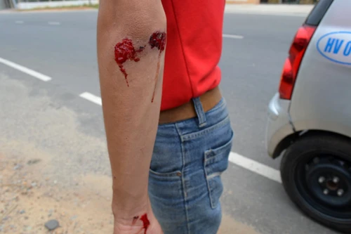 4 phóng viên bị côn đồ tấn công khi đang tác nghiệp