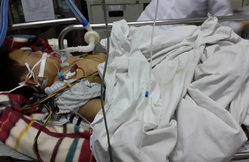 Bắt đối tượng dùng điếu cày đánh con trai dã man, gây chấn thương sọ não