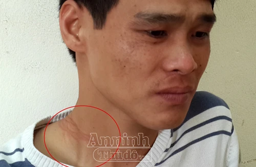 “Ngáo đá” vác dao nhảy xuống sông Hồng vì ảo giác có người đang rượt đuổi